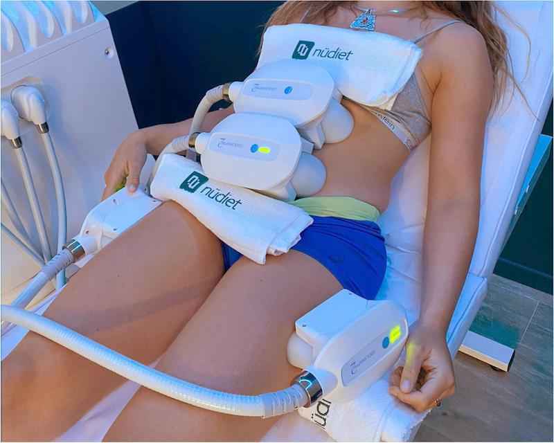 Cryolipolyse